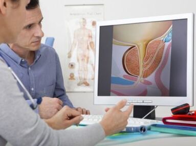 Urolog savjetuje pacijenta o problemima s potencijom